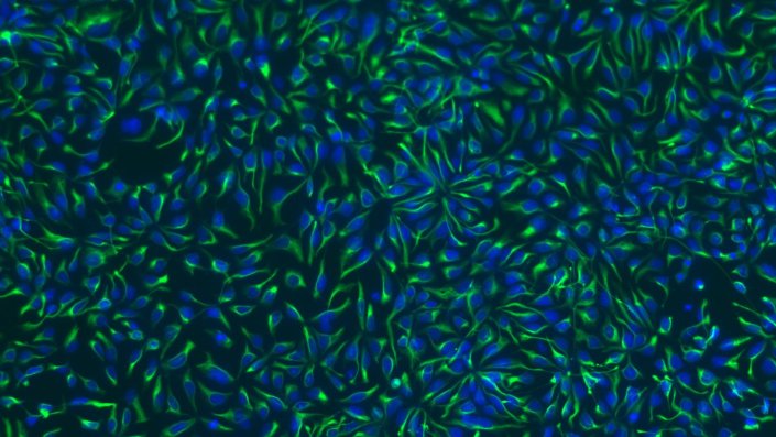 Immunfluoreszenzaufnahme von iPSC-abgeleiteten humanen neuronalen Vorläuferzellen Immunfluoreszenzaufnahme von iPSC-abgeleiteten humanen neuronalen Vorläuferzellen