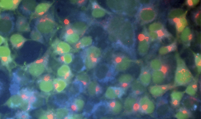 mikroskopische Visualisierung rekombinanter Zelllinien in Kultur, die nach genetischer Modifikation das DOM-7 Protein (Rot) der Maus und das Grüne Fluoreszenz Protein (GFP; Grün) produzieren. Außerdem wurde das Organell Endoplasmatisches Retikulum (Blau) der Zellen angefärbt. mikroskopische Visualisierung rekombinanter Zelllinien in Kultur, die nach genetischer Modifikation das DOM-7 Protein (Rot) der Maus und das Grüne Fluoreszenz Protein (GFP; Grün) produzieren. Außerdem wurde das Organell Endoplasmatisches Retikulum (Blau) der Zellen angefärbt.