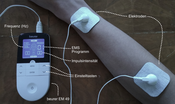 EMS - Elektroden am Arm