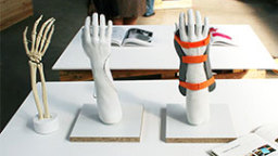 Handschiene "Orthostruct" (Bild: Marina Scheinberg) Handschiene "Orthostruct" (Bild: Marina Scheinberg)