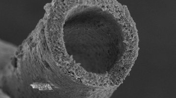 Rasterelektronenmikroskop-Aufnahme der MemO2 Faser (Bild: Institut für Pathologie vom Uniklinikum Aachen)