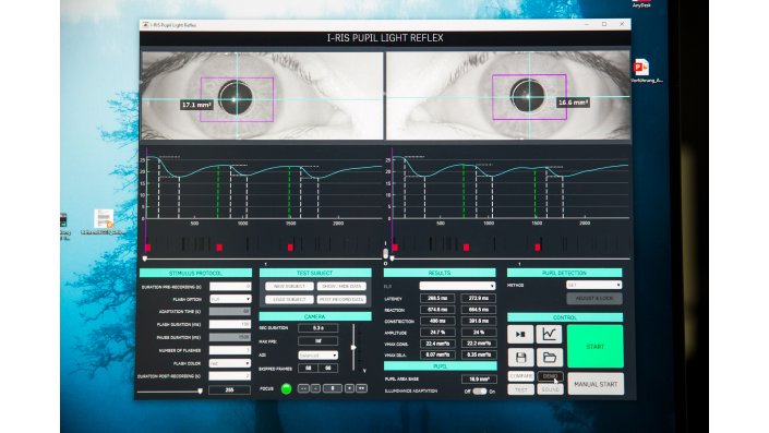 Bildschirm mit Auswertung einer Augenmessung