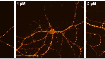 Neuronen (Bild: Laura Kalinski)