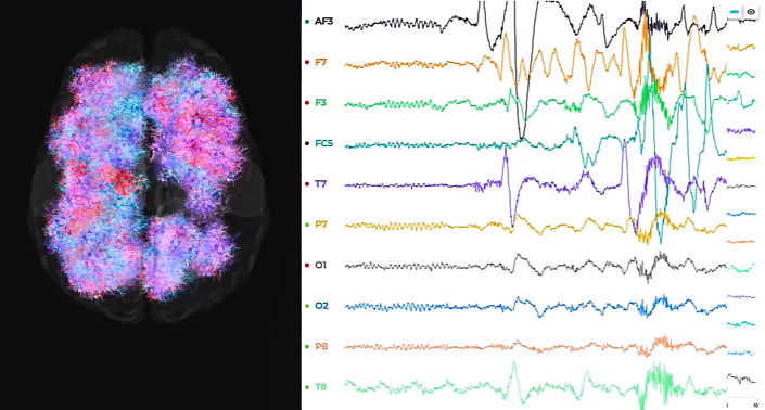 Links ist ein Gehirn rechts ein EEG