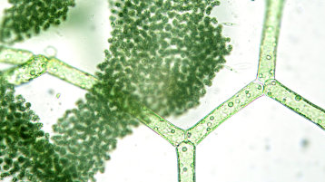 Biosysteme - Mikroorganismen (Bild: SrjT)